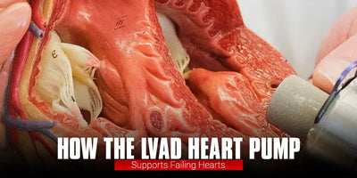 How the LVAD Heart Pump Supports Failing Hearts